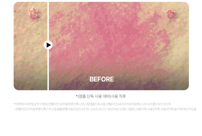 Centellian24 - Madeca Prime Max (Hyper Lifting & Firming Beauty Device)