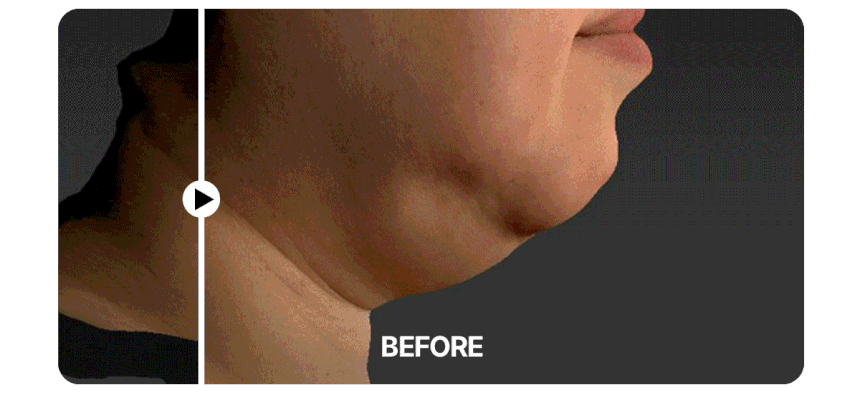 Centellian24 - Madeca Prime Max (Hyper Lifting & Firming Beauty Device)