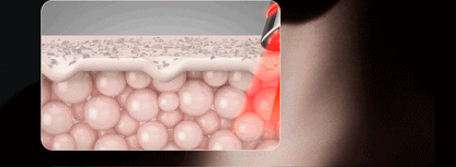 Centellian24 - Madeca Prime Max (Hyper Lifting & Firming Beauty Device)