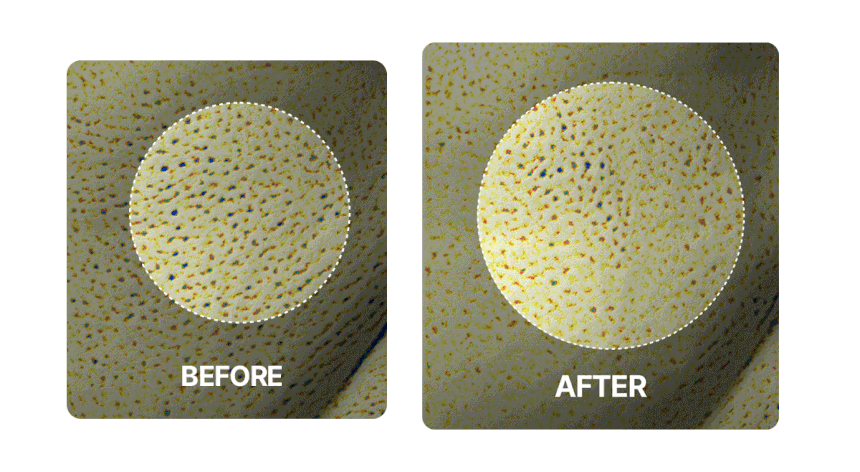 Centellian24 - Madeca Prime Max (Hyper Lifting & Firming Beauty Device)