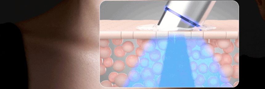 Centellian24 - Madeca Prime Max (Hyper Lifting & Firming Beauty Device)