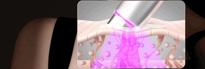 Centellian24 - Madeca Prime Max (Hyper Lifting & Firming Beauty Device)