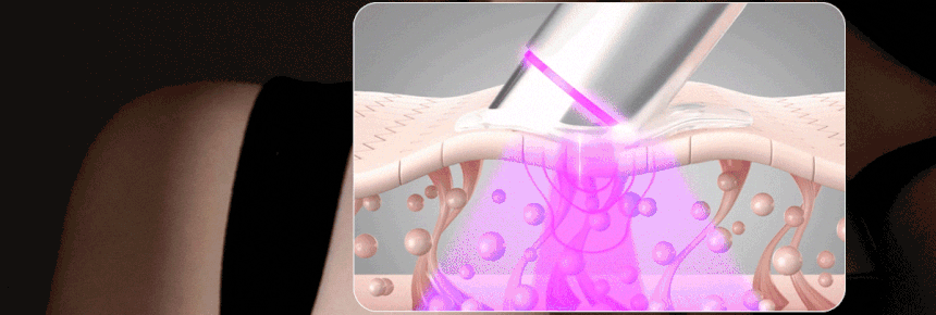 Centellian24 - Madeca Prime Max (Hyper Lifting & Firming Beauty Device)