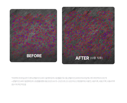 Centellian24 - Madeca Prime Max (Hyper Lifting & Firming Beauty Device)