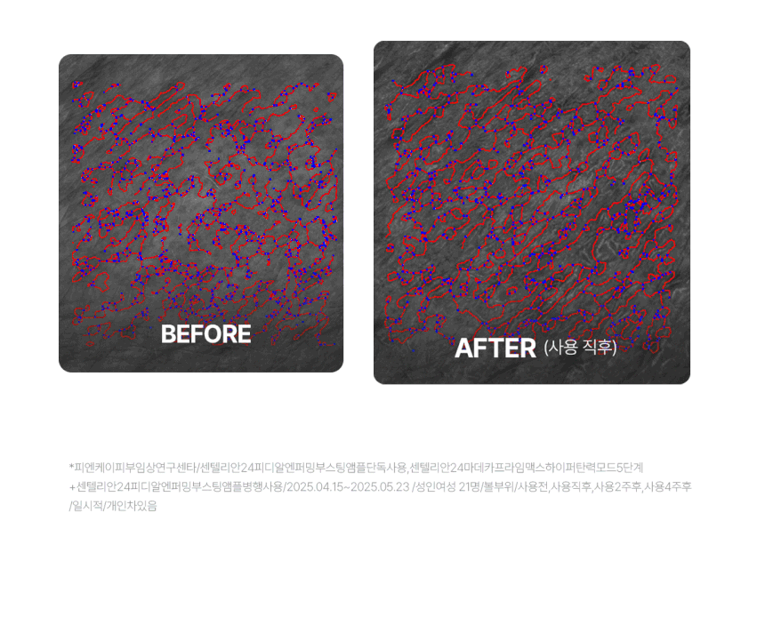 Centellian24 - Madeca Prime Max (Hyper Lifting & Firming Beauty Device)