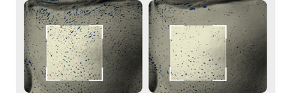 Medicube - Booster Pro Mini Plus