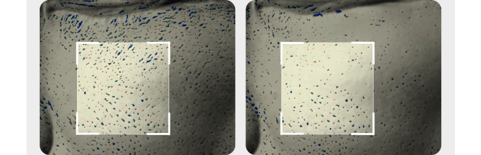 Medicube - Booster Pro Mini Plus