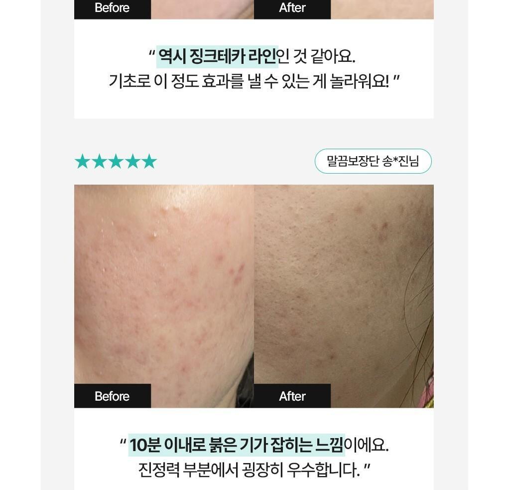 BRINGGREEN X ANKYUNGMANDOO - Zinc TECA Repair Cream 80ml