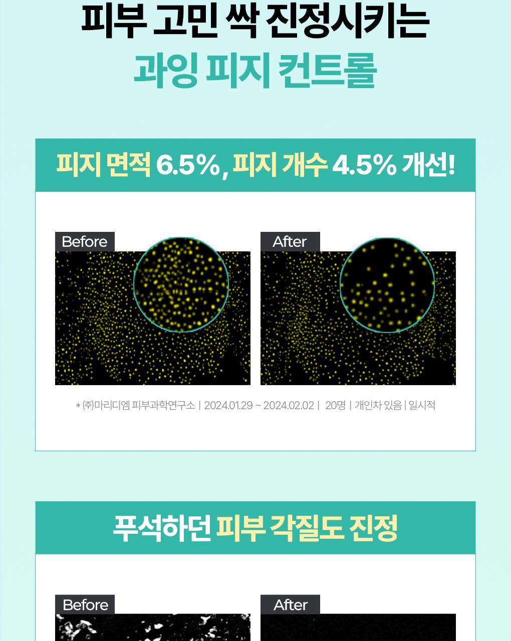 BRINGGREEN - Tea Tree Cica Soothing Toner 500ml (+Serum 3ml)