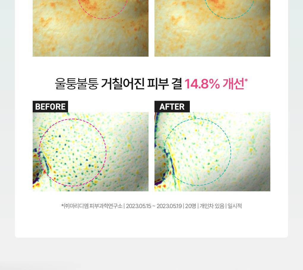 BRINGGREEN X ANKYUNGMANDOO - Zinc TECA Blemish Serum