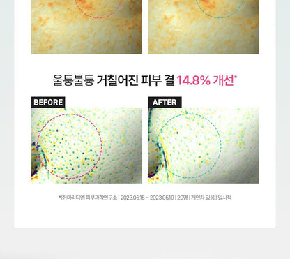 BRINGGREEN X ANKYUNGMANDOO - Zinc TECA Blemish Serum