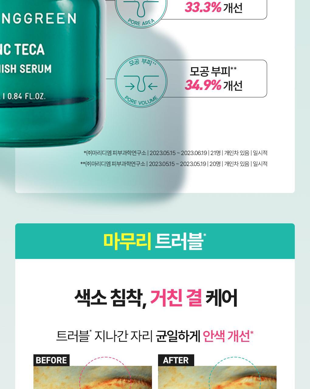 BRINGGREEN X ANKYUNGMANDOO - Zinc TECA Blemish Serum