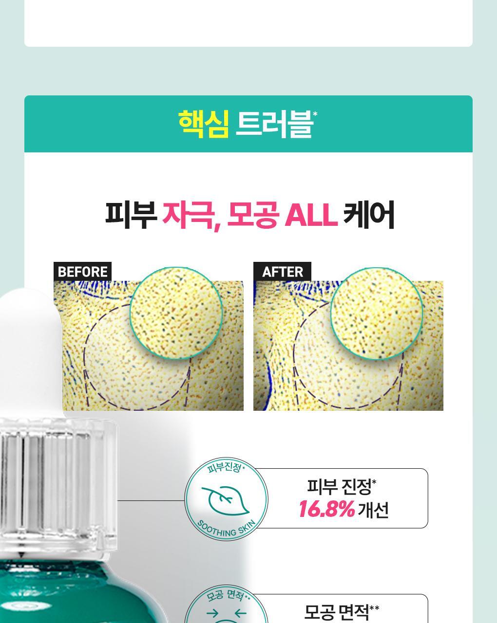 BRINGGREEN X ANKYUNGMANDOO - Zinc TECA Blemish Serum