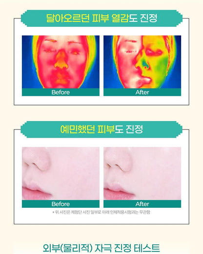 BRINGGREEN X ANKYUNGMANDOO - Tea Tree Cica Soothing Toner (500ml / 250ml)