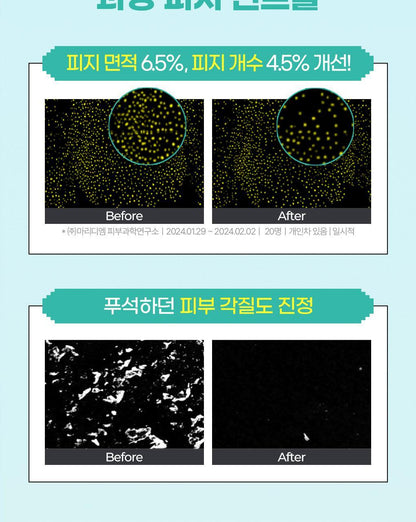 BRINGGREEN X ANKYUNGMANDOO - Tea Tree Cica Soothing Toner (500ml / 250ml)