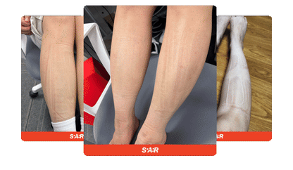 [SPAR] - Portable Leg Massager PRO V2 (Calf Massager)