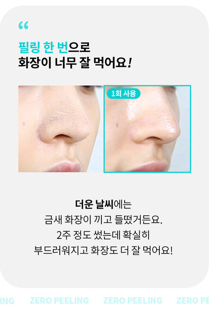 face factory - ZERO PEELING (Pore Cleansing Device) (PEANUTS Edition)