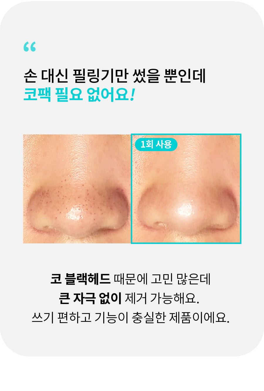 face factory - ZERO PEELING (Pore Cleansing Device) (PEANUTS Edition)